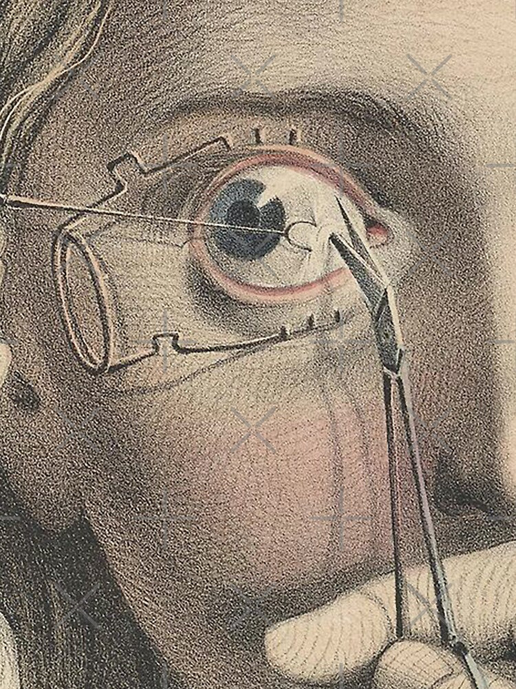 Freak VIntage Medical Illustration Dark Art Aesthetic Dark Academia by CattlettArt